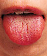 紅舌